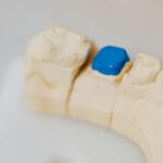 Model szczęki z niebieską wypełnioną koroną i narzędziami stomatologicznymi