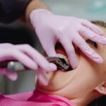 Dentysta wykonuje zabieg usunięcia zęba u pacjenta